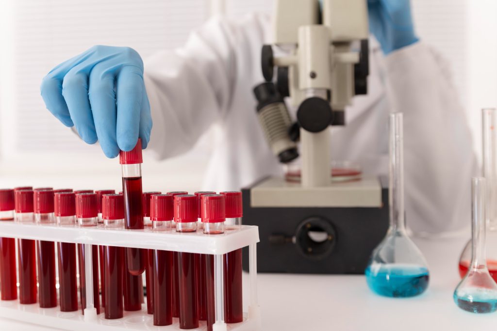Learn Professional Phlebotomy Techniques to Advance Your Career