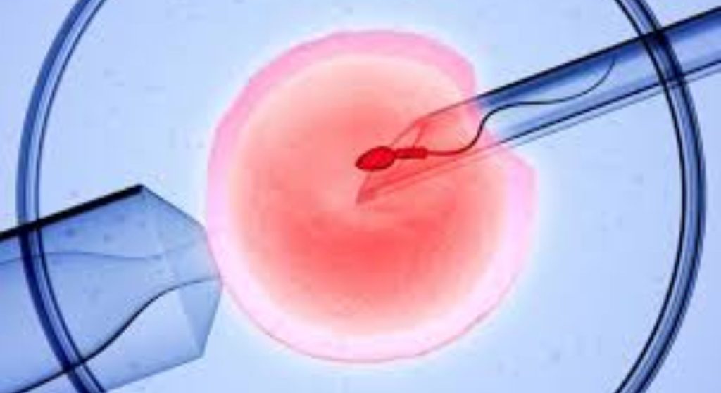 ivf treatment image