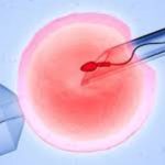 ivf treatment image